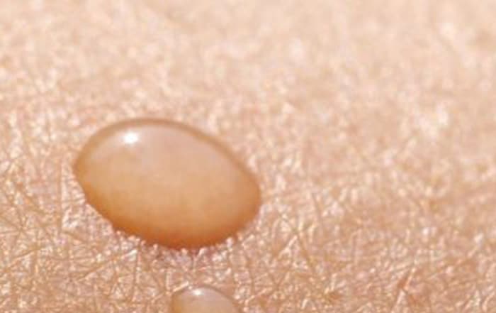 What is the skin microbiome and how to take care of it?